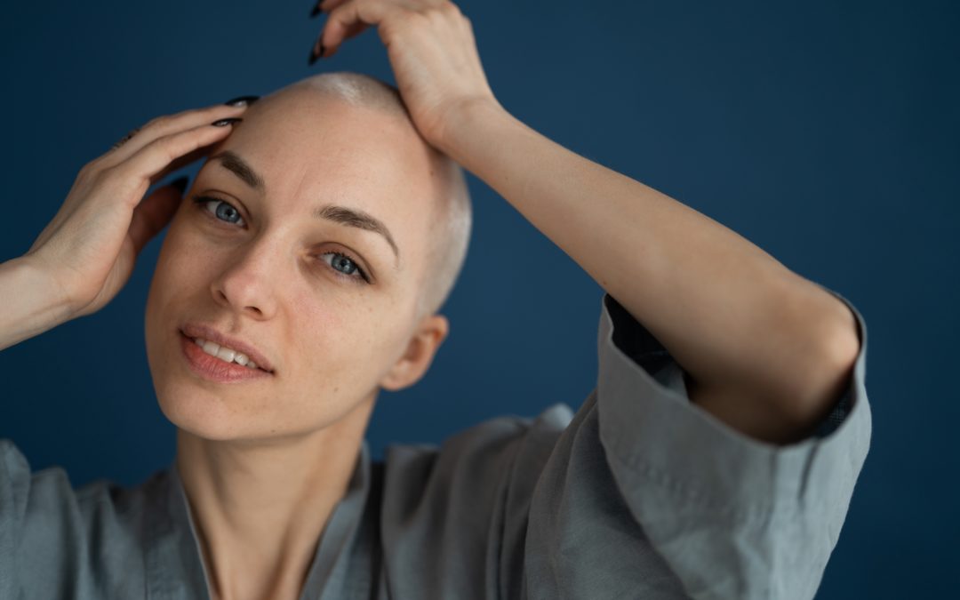 What It’s Like to Have Alopecia