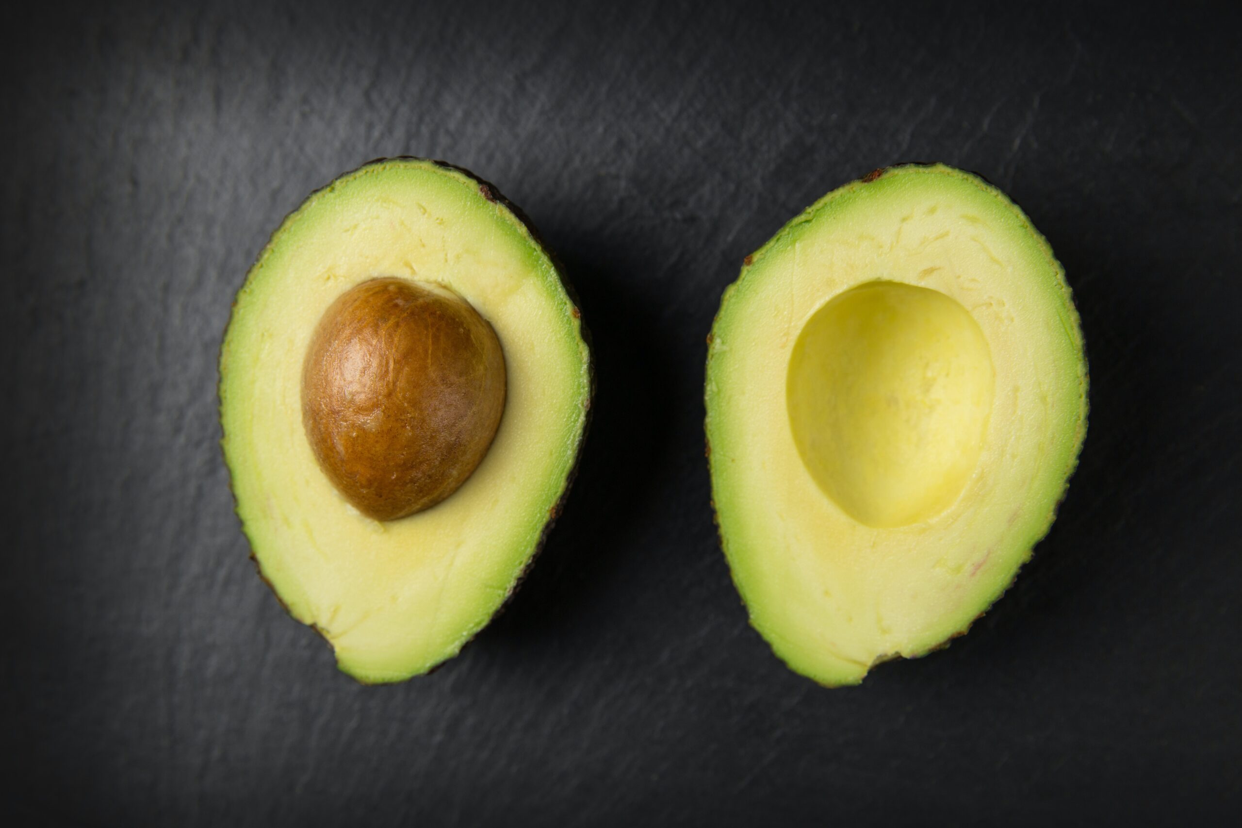 Amazing Avocadoes: Health Benefits and Best Ways to Eat Them